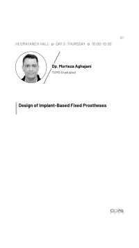 design of implant-based fixed prostheses