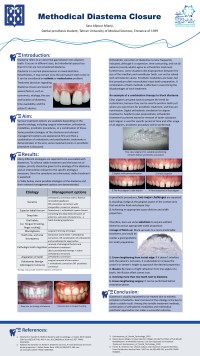 Methodical diastema closure