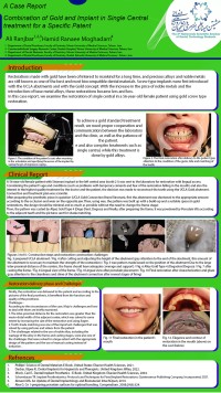 Combination of Gold and Implant in Single Central Treatm for a Specific Patentent