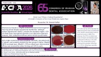 Diode Laser 970nm or Sodium Hypochlorite? A Scientific Evaluation of Root Canal Disinfection Against Hype