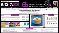 Evaluation of fracture resistance of maxillary premolar teeth restored with amalgam-composite combination technique: an in vitro study
