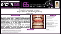 Orthodontic treatment vs veneers (in patients with orthodontic problems)