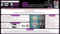Principles and Indications of Vital Pulp Therapy in Complicated Crown Freacture of Permanent Teeth