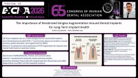 The Importance of Keratinized Gingiva Augmentation Around Dental Implants  for Long-Term Implant Health
