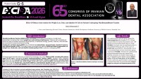 Effect Of Dietary Intervention On Weight Loss, Pain, And Quality Of Life In Patients Undergoing Maxillomandibular Fixation