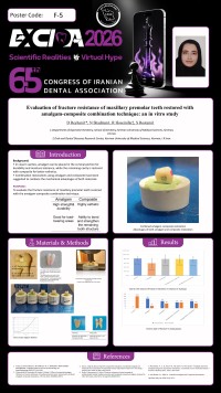 Evaluation of fracture resistance of maxillary premolar teeth restored with amalgam-composite combination technique: an in vitro study